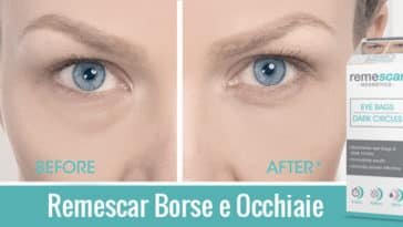 remescar-opinioni-recensioni